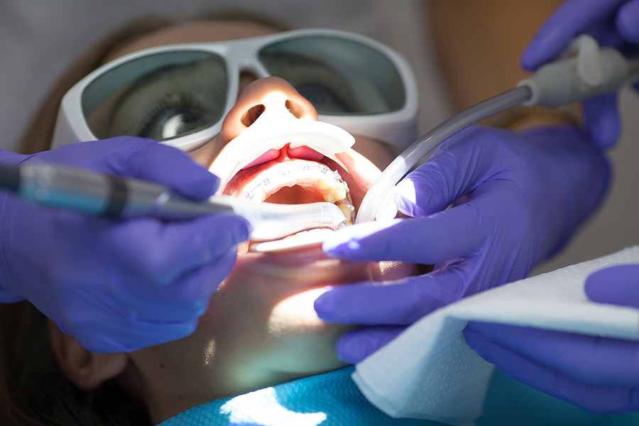Innovative Precision: Exploring the Benefits of Dental Laser Surgery